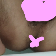 Bivirginanal